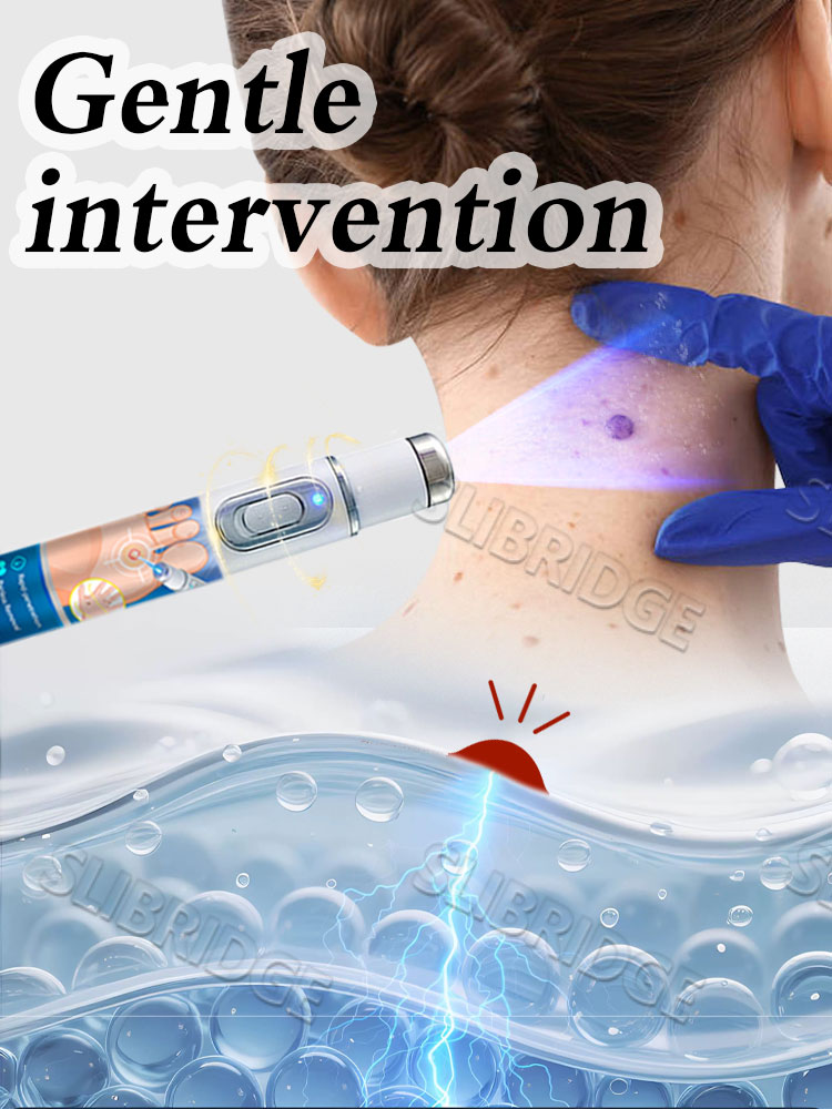 Powerful blue pen wart removal - Combo Power Tools recension och pris